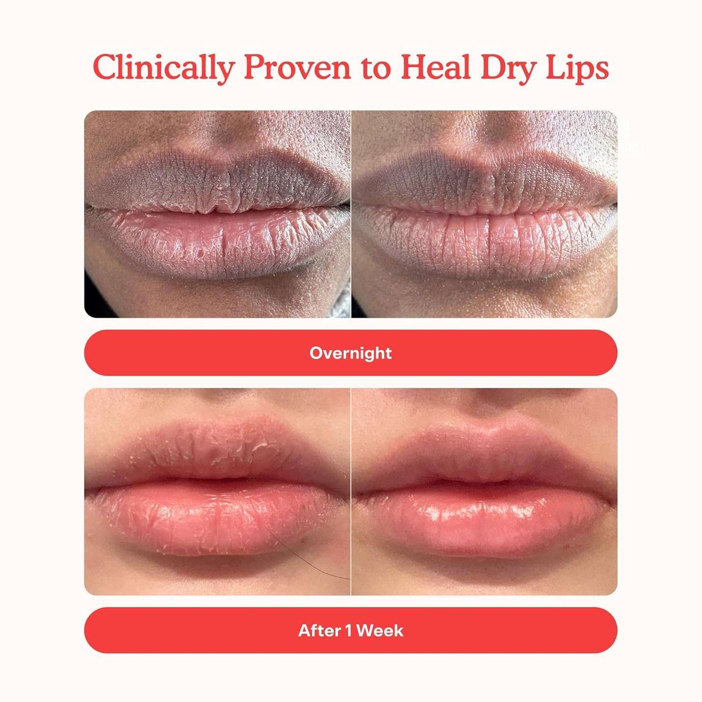 Tower 28 LipSoftie Hydrating Tinted Lip Treatment Balm, Moisturizing Lip Mask for Chapped Lips