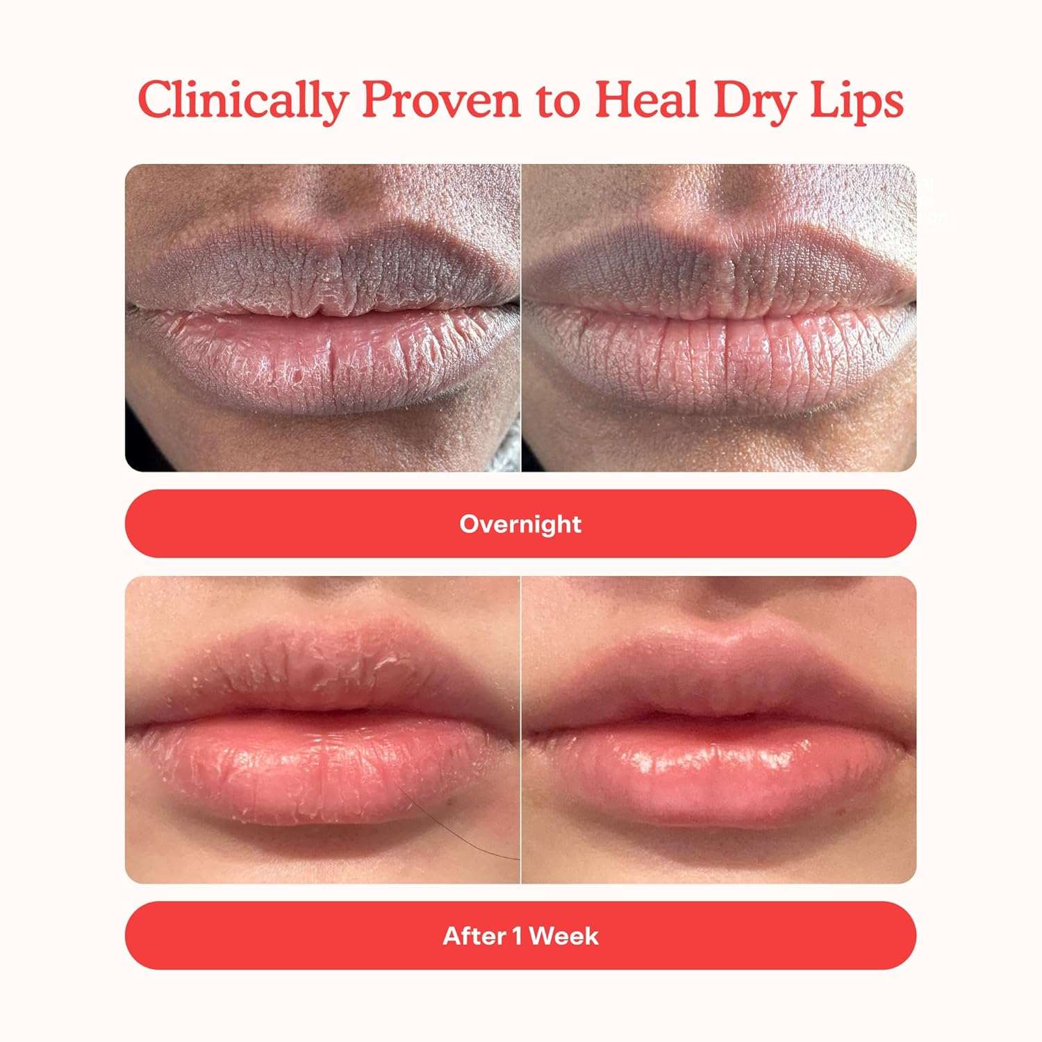 Tower 28 LipSoftie Hydrating Tinted Lip Treatment Balm, Moisturizing Lip Mask for Chapped Lips